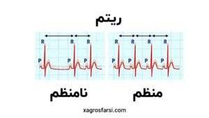 انواع ریتم در تدوین